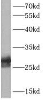 APOD Rabbit Polyclonal Antibody