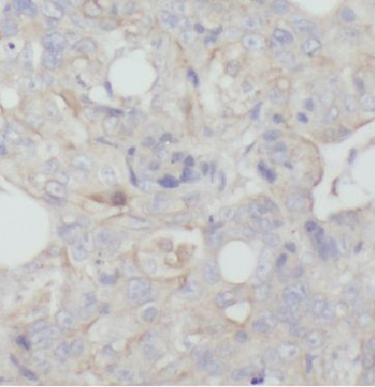 APOD Rabbit Polyclonal Antibody