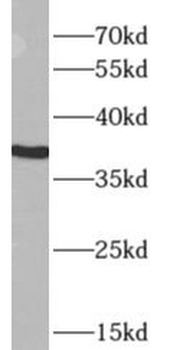 APOL2 Rabbit Polyclonal Antibody