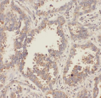 APOL2 Rabbit Polyclonal Antibody