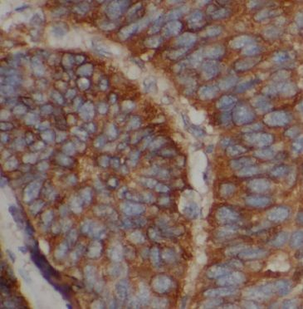 APOM Rabbit Polyclonal Antibody