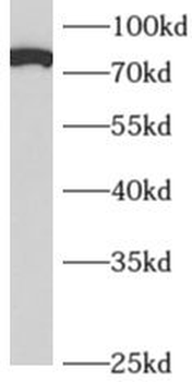 APPL1 Rabbit Polyclonal Antibody