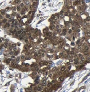 APPL1 Rabbit Polyclonal Antibody