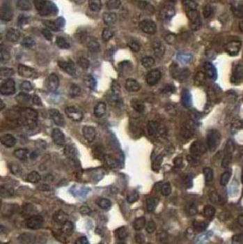 APPL1 Rabbit Polyclonal Antibody