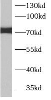 APPL2 Rabbit Polyclonal Antibody