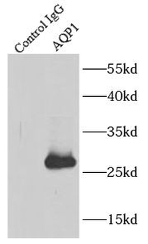 AQP1 Rabbit Polyclonal Antibody