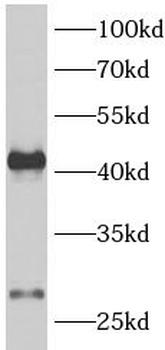AQP1 Rabbit Polyclonal Antibody