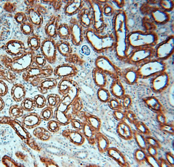 AQP1 Rabbit Polyclonal Antibody