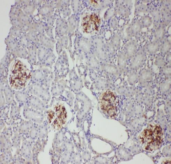 AQP4 Rabbit Polyclonal Antibody
