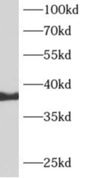 ARFIP2 Rabbit Polyclonal Antibody