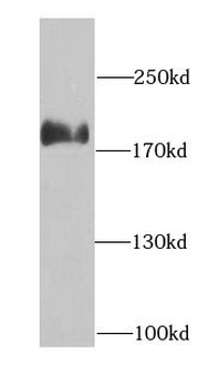 ARHGAP5 Rabbit Polyclonal Antibody