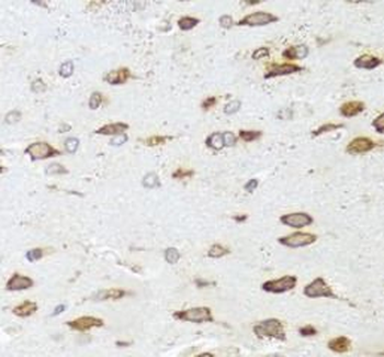 ARHGAP5 Rabbit Polyclonal Antibody