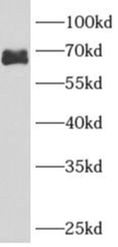 ARHGAP9 Rabbit Polyclonal Antibody