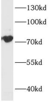 ARHGEF4 Rabbit Polyclonal Antibody