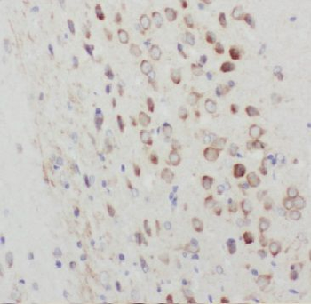 ARHGEF4 Rabbit Polyclonal Antibody
