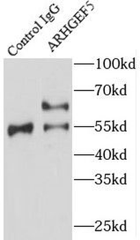 ARHGEF5 Rabbit Polyclonal Antibody