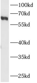 ARHGEF5 Rabbit Polyclonal Antibody