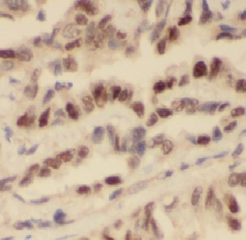 ARHGEF5 Rabbit Polyclonal Antibody