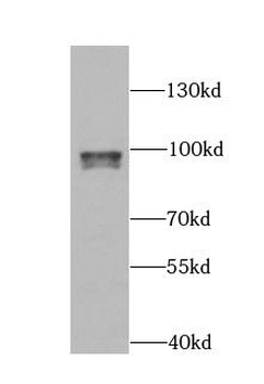 ARID3A Rabbit Polyclonal Antibody