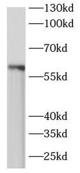 ARIH2 Rabbit Polyclonal Antibody