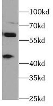ARL13B Rabbit Polyclonal Antibody