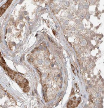 ARL13B Rabbit Polyclonal Antibody