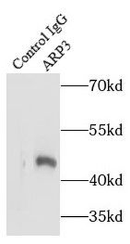 ACTR3 Rabbit Polyclonal Antibody
