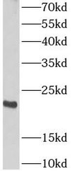 ARPC4 Rabbit Polyclonal Antibody