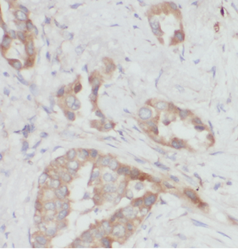ARPC4 Rabbit Polyclonal Antibody
