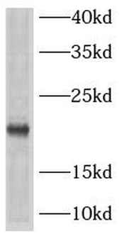 ARPC5 Rabbit Polyclonal Antibody