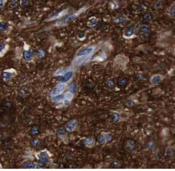 ARPC5 Rabbit Polyclonal Antibody