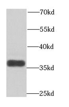 ART5 Rabbit Polyclonal Antibody