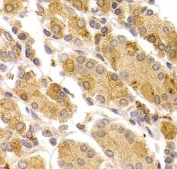 ART5 Rabbit Polyclonal Antibody