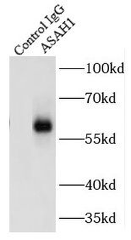 ASAH1 Rabbit Polyclonal Antibody