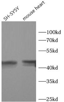 ASAH1 Rabbit Polyclonal Antibody