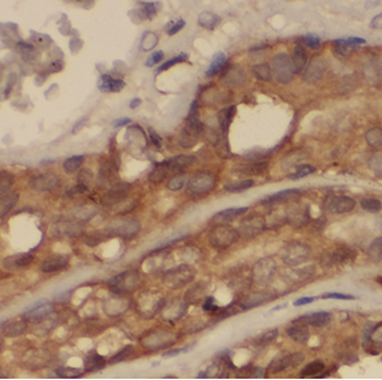 ASAH1 Rabbit Polyclonal Antibody