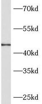 CLMP Rabbit Polyclonal Antibody