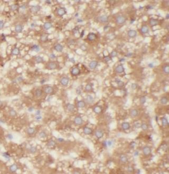 ASGR1 Rabbit Polyclonal Antibody