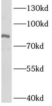 ASH2L Rabbit Polyclonal Antibody