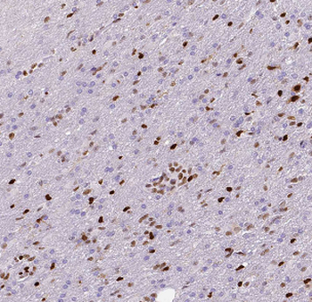 ASH2L Rabbit Polyclonal Antibody