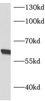 ASNS Rabbit Polyclonal Antibody