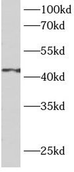 ASS1 Mouse Monoclonal Antibody