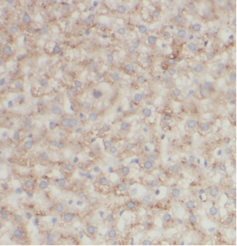 ASS1 Mouse Monoclonal Antibody