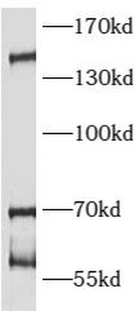 ATAD5 Rabbit Polyclonal Antibody