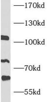 ATF6B Rabbit Polyclonal Antibody