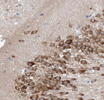 ATF6B Rabbit Polyclonal Antibody