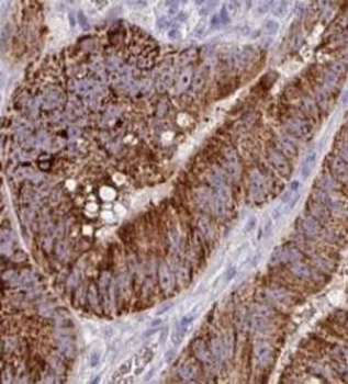ATG16L1 Rabbit Polyclonal Antibody