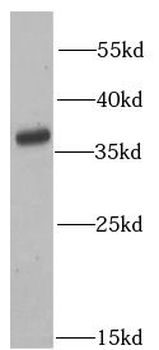 ATG3 Rabbit Polyclonal Antibody