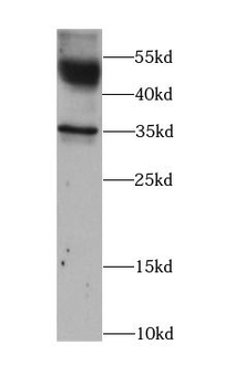 ATP1B1 Rabbit Polyclonal Antibody