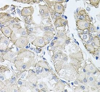 ATP1B1 Rabbit Polyclonal Antibody